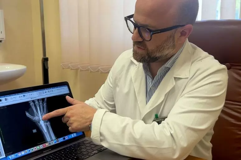 Bari: impiantata la prima protesi al polso nel sud Italia